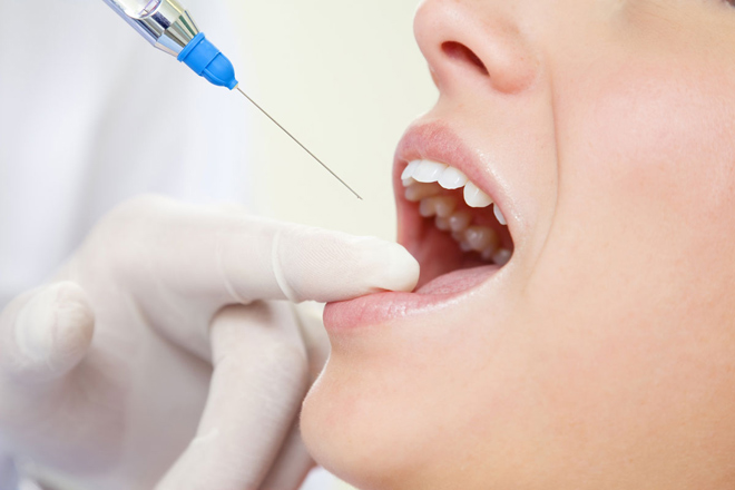 Когда необходимо проведение имплантации зубов под общим наркозом?