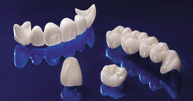 Картинки по запросу Протезирование зубов. Ортопедическая стоматология